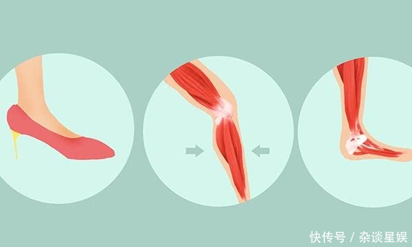  [女性]长期穿高跟鞋的女性，十年后，身体会变成什么样？是好是坏？