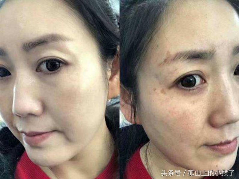 38岁女人长出“老年斑”别慌张，有一小妙招，轻松去斑不东奔西跑