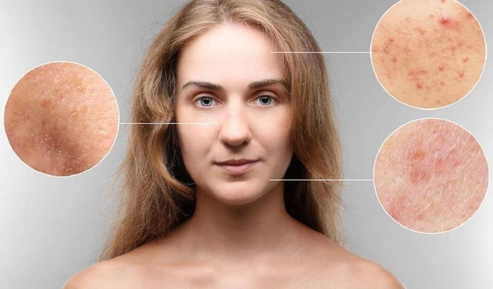 鼻子上挤出来的东西，分好几种，你知道几种呢?