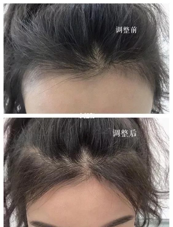 丸子头暴露发际线？4步修容大法拿好不谢！内附头发养护tips~