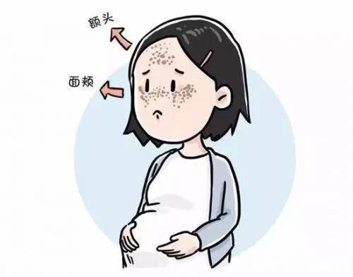  不妨@脸上有斑怎么办？不妨看看这个