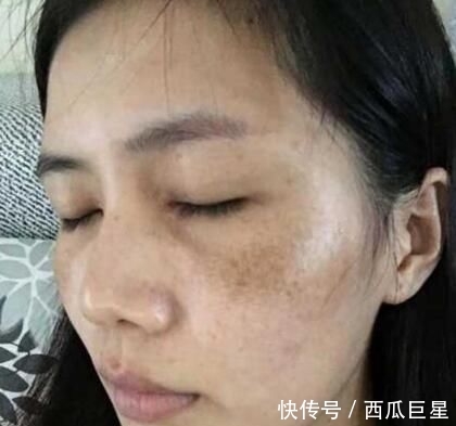  皮肤不好■淘米水中加点“它”，坚持敷脸半个月，皮肤又白又嫩，色斑都淡了