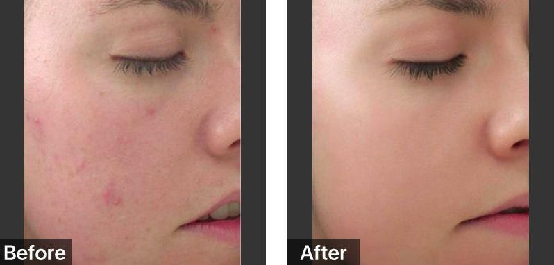 佟大为关悦“老夫老妻”霸屏综艺，演技开挂甜腻如初恋!