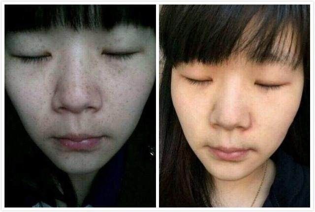 小小一块姜，祛斑美白大作用，只需睡前涂两下，肤如凝脂白如玉