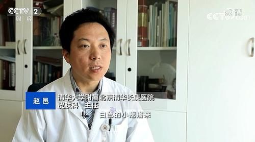 『护肤品』【快看·健康】眼周长脂肪粒是护肤品太过营养吗?
