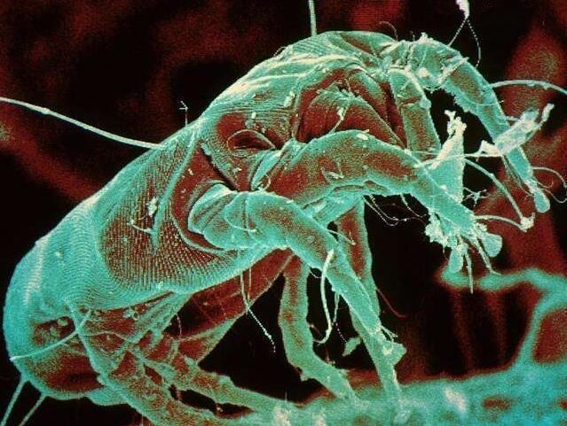 后背不停长痘痘, 可能毛孔被上亿只螨虫掏空, 用上3方法祛痘很快