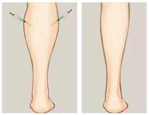 试过那么多瘦腿方法都没成功，最有效的居然只有3分钟！