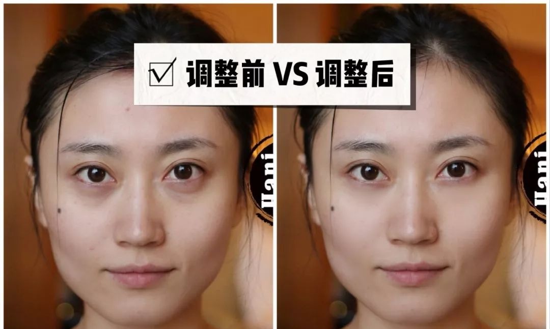 「衰老问题」素人整形分析 | 做对这些,宽方脸比瓜子脸更有优势