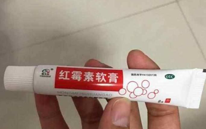  #皮肤上#红霉素软膏还有这几种妙用，很多人都不知道，快来看看吧