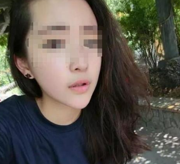 24岁女子鼻子经常有股恶臭味,医院检查后,取出的东西让人无语
