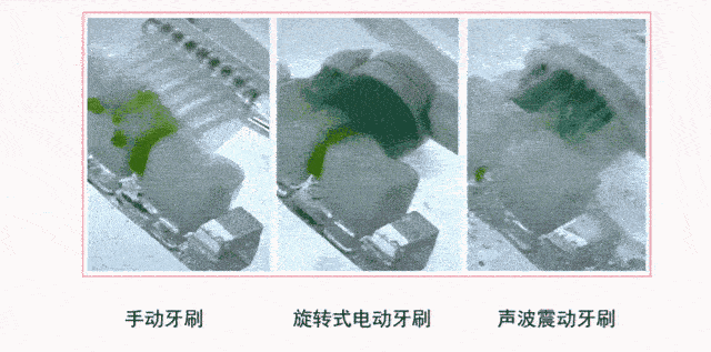 中招@精致的女生这3个地方都很白,有一处发黄都会影响颜值,你中招没