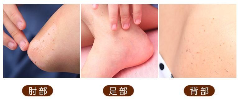 整容遭报应?她的少女脸这么快就烂了?