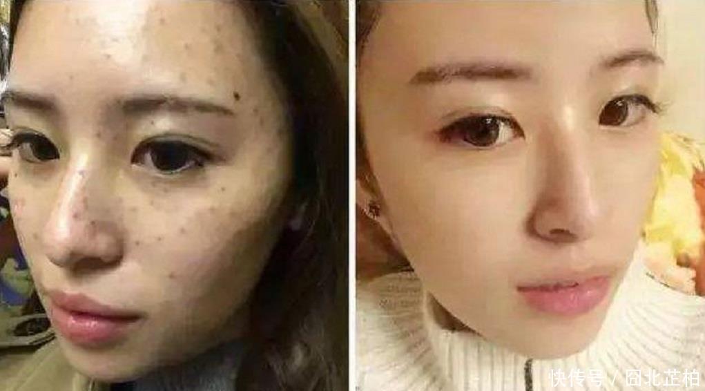 『省钱』柠檬加“它”来敷脸,一个月色斑、皱纹变淡不少,简单好用又省钱