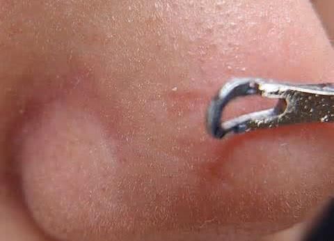 鼻子上布满黑头，分享四个去黑头技巧，让肌肤干净起来