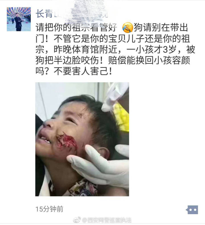西安体育馆3岁小女孩子被狗咬半边脸?系谣言!