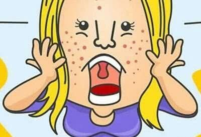  【白净】黑头太多不要怕, 巧用四招搞定草莓鼻, 白净无瑕的对手