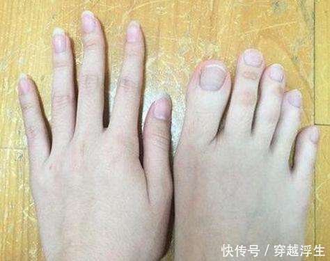 女子去美容店做按摩，脱下鞋后技师表示，按摩这么多年第一次遇到