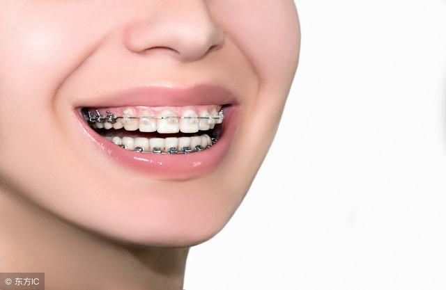 牙医最想澄清的谣言，竟然有这么多人相信？