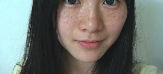 真实祛斑的几种办法和斑说拜拜