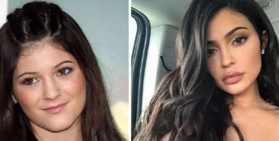 卡戴珊小妹取出假体之后，恢复颜值巅峰的状态！一身穿搭美呆了