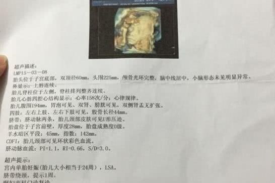 『肚子』B超单3个孕检“数据”,暗示肚子里是“小王子”,你占了几条