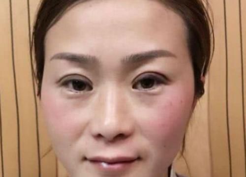 女生@被吓出一身冷汗,为何现在越来越少的女生割双眼皮?看到变化史后
