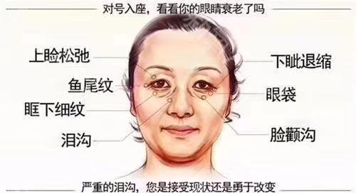  [皮肤]不止黑眼圈显老，还有这些要注意！