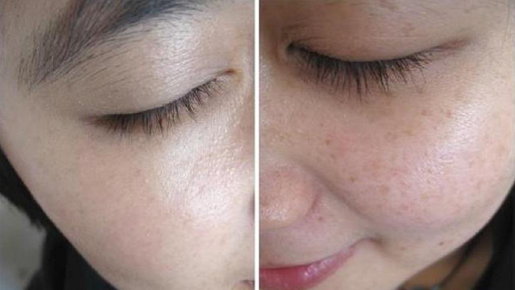  [脸部]生姜加“它”涂抹脸部，一个月淡化色斑又嫩肤，皮肤变得白皙光滑