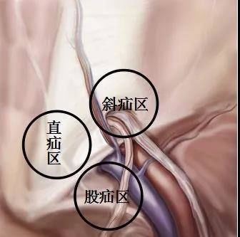 『手记』医者手记｜勿以“疝”小而不为，茶农大伯痛得差点受不了