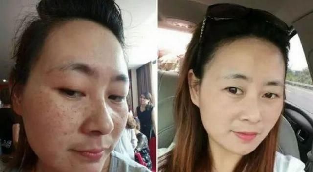 学到■生姜加上常见的“它”敷脸，不出15天脸上色斑变淡，学到就是赚到