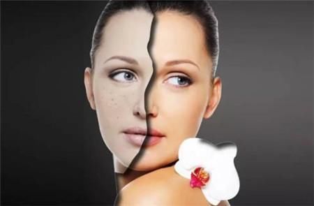 蜂蜜只知道用来喝？别浪费了，这样涂脸斑点全都消失了