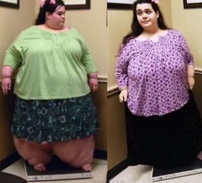 580斤的女子一年减肥成赫本,男友表示终于可以和她亲密了