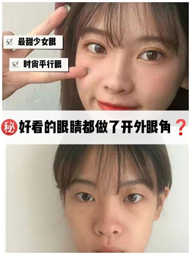  【随便】想要日系无辜大眼惨遭医生拒绝？为啥外眼角不能随便开