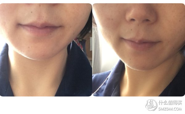 【好物分享】 篇十一:种草-法国医美药妆品牌菲洛嘉试用体验，未