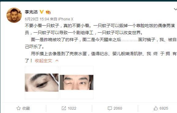 三线男星被蚊子咬，耍大牌停工，称:1个小蚊子可以改变世界?