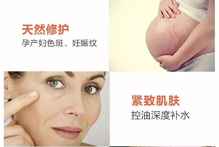 新西兰天然野生黑蕨修护精华，超强补水无刺激，敏感肌肤和孕产妇