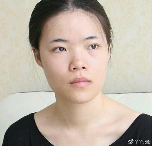  鼻炎@有鼻炎能不能做隆鼻手术?效果好吗？有危险吗？