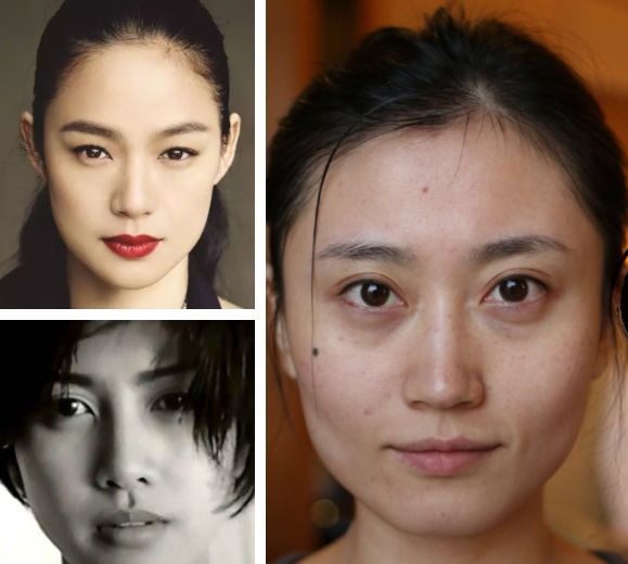 「衰老问题」素人整形分析 | 做对这些,宽方脸比瓜子脸更有优势
