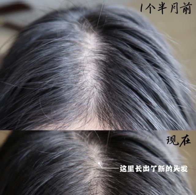  脱发@屈臣氏有款“断货王”，被称洗发水界的阿玛尼，知道的人却很少！