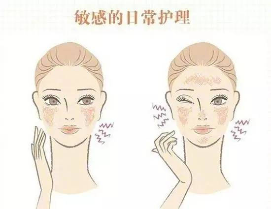 红血丝用哪种洗面奶 红血丝适合的洗面奶