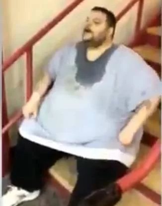 体重600多斤的小伙，疯狂减掉400斤，结果皮肤竟变成了这样！