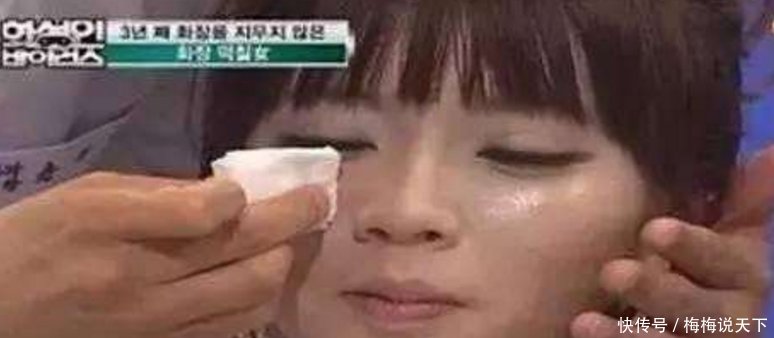 美女患了这个怪病，三年多不洗脸，妆擦下来都厚厚一层
