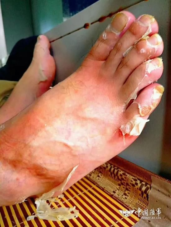 走近中国最西中印边境