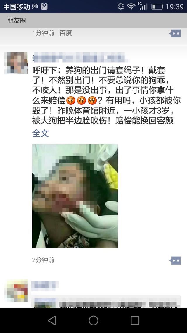 FM889小孩被狗咬伤半边脸？疯传滨州人朋友圈！真相是这样的！