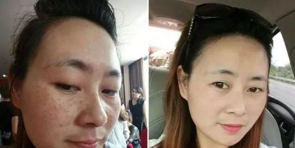  『恢复』啤酒加它一起,坚持敷脸,淡斑美白皮肤恢复白皙细致