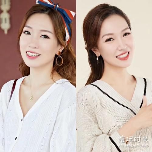  「快乐」年糕妈妈：偷偷整牙两年，终于敢给你看对比照了
