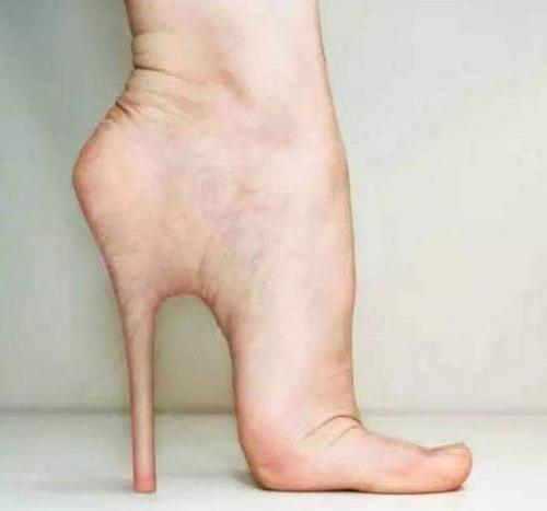 那些长期穿高跟鞋的,脚都变成什么样了?