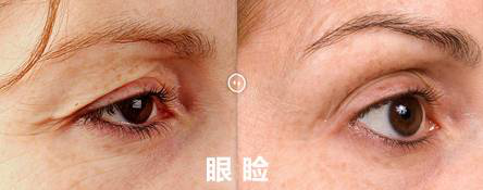 话说抗衰效果惊艳的，Number one深圳联合丽格的热玛吉