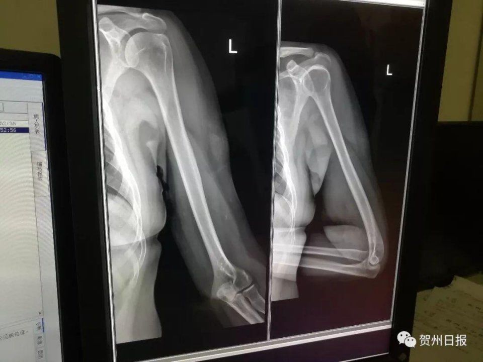 网传贺州城管打人?市综合执法局已报警!真相到底如何?