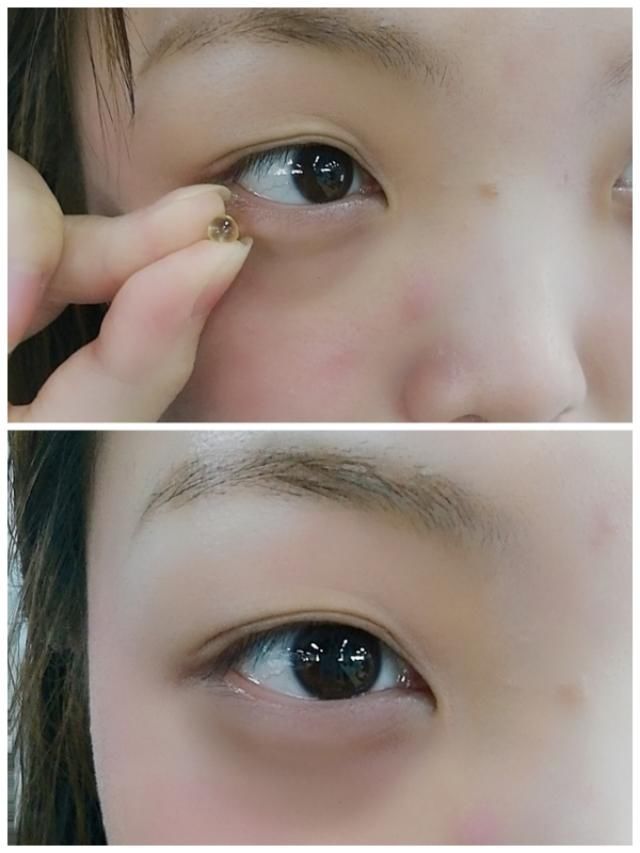 药店2块钱的VE+5个动作，7天消细纹+黑眼圈！